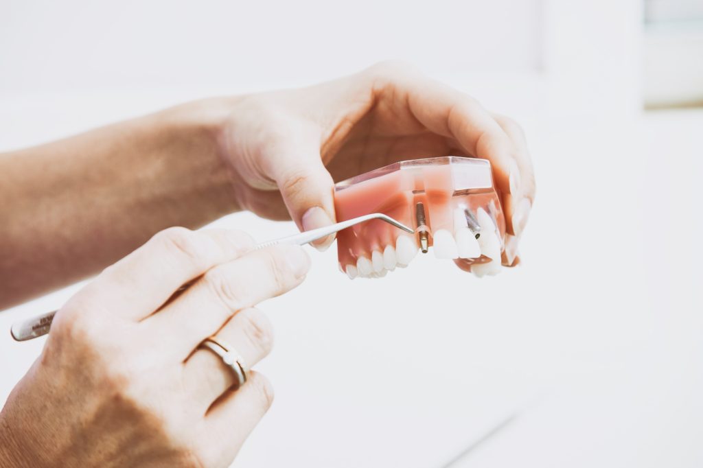 The fast and easy way for your patient to get a spare set of dentures.